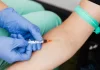 Co może zaburzyć prawidłowy wynik analizy poziomu HGH? lab-med.pl - 244-co-moze-zaburzyc-prawidlowy-wynik-analizy-poziomu-hgh.webp